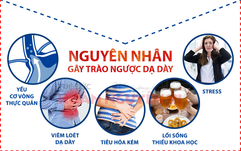 may loc nuoc dien giai kangen