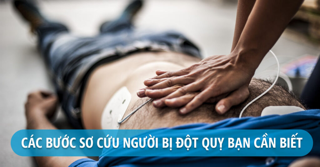 Mẹo xử lý khi mắc bệnh đột quỵ