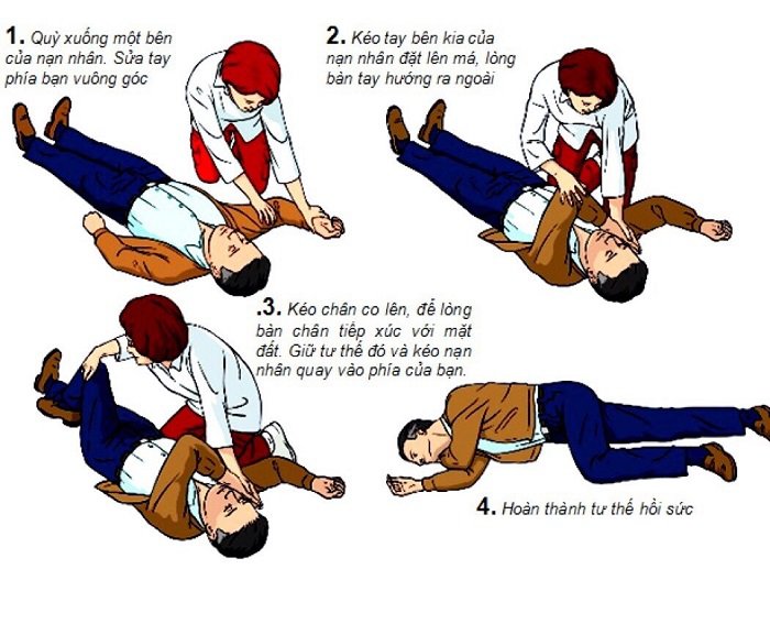 bệnh đột quỵ