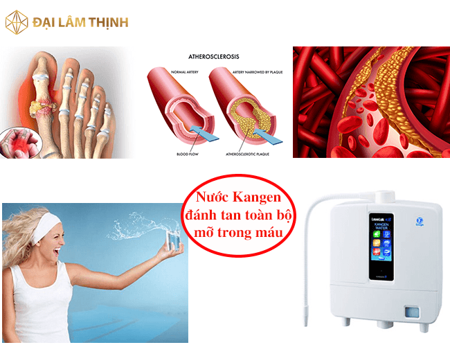 may loc nuoc dien giai kangen