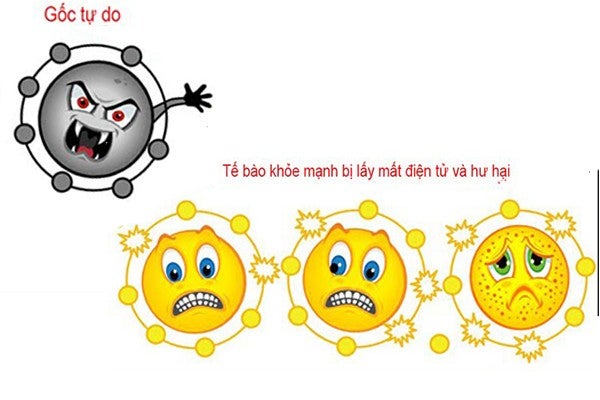 Gốc tự do l