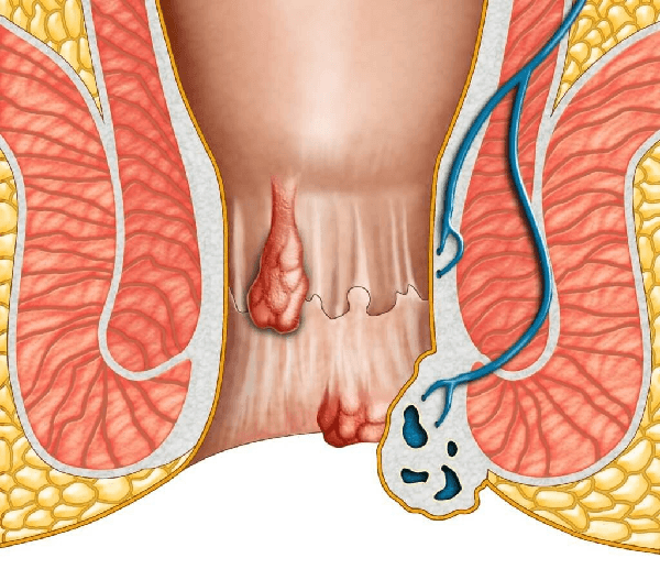 Các trợ phương theo phương pháp dưỡng sinh (phần 3)