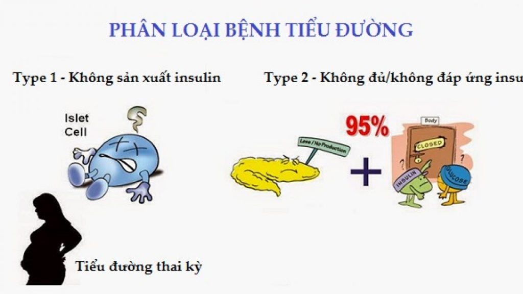 Bạn đã biết gì về bệnh tiểu đường?