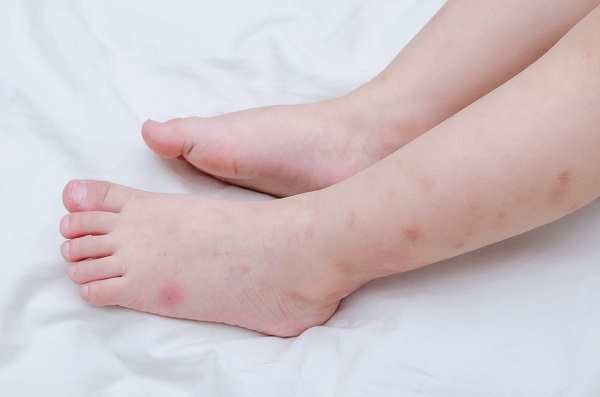 Công dụng của nước Kangen (phần 1)