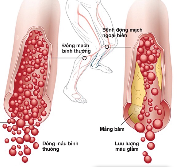 Các trợ phương theo phương pháp dưỡng sinh