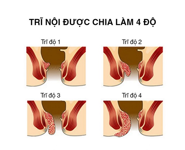 Các bệnh về hệ tiêu hóa